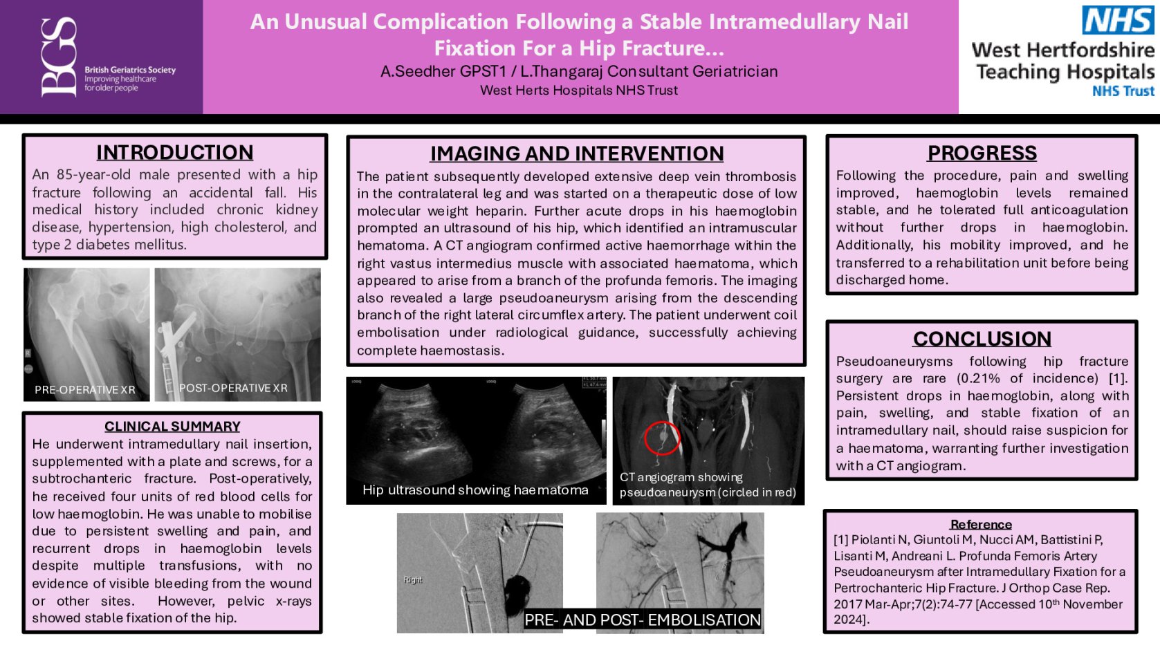 An Unusual Complication Following a Stable Intramedullary Nail Insertion For a Hip Fracture…  poster preview image