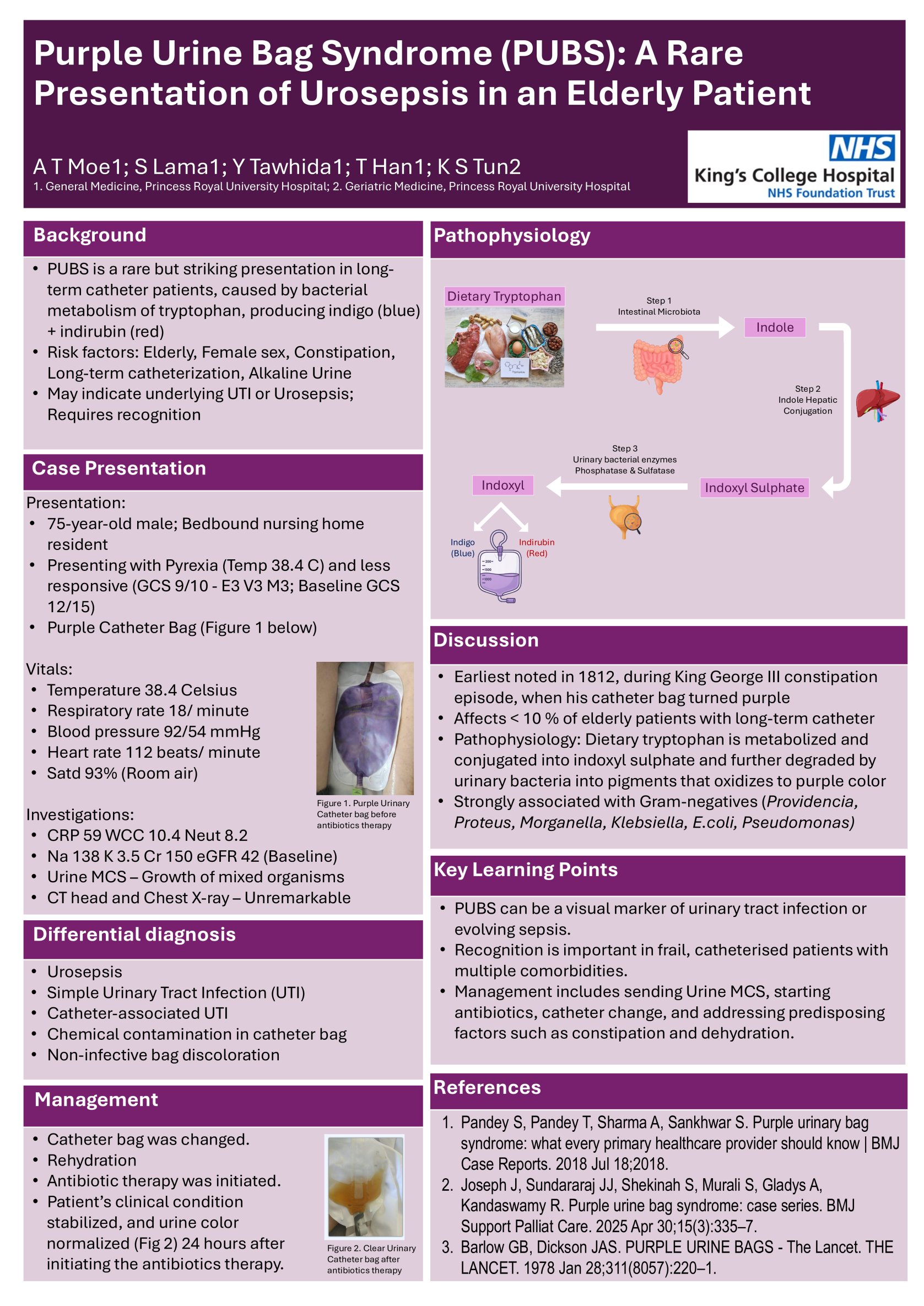 Purple Urine Bag Syndrome (PUBS) in a Bedbound Nursing Home Resident: A Rare Presentation of Urosepsis in an Elderly Patient poster preview image