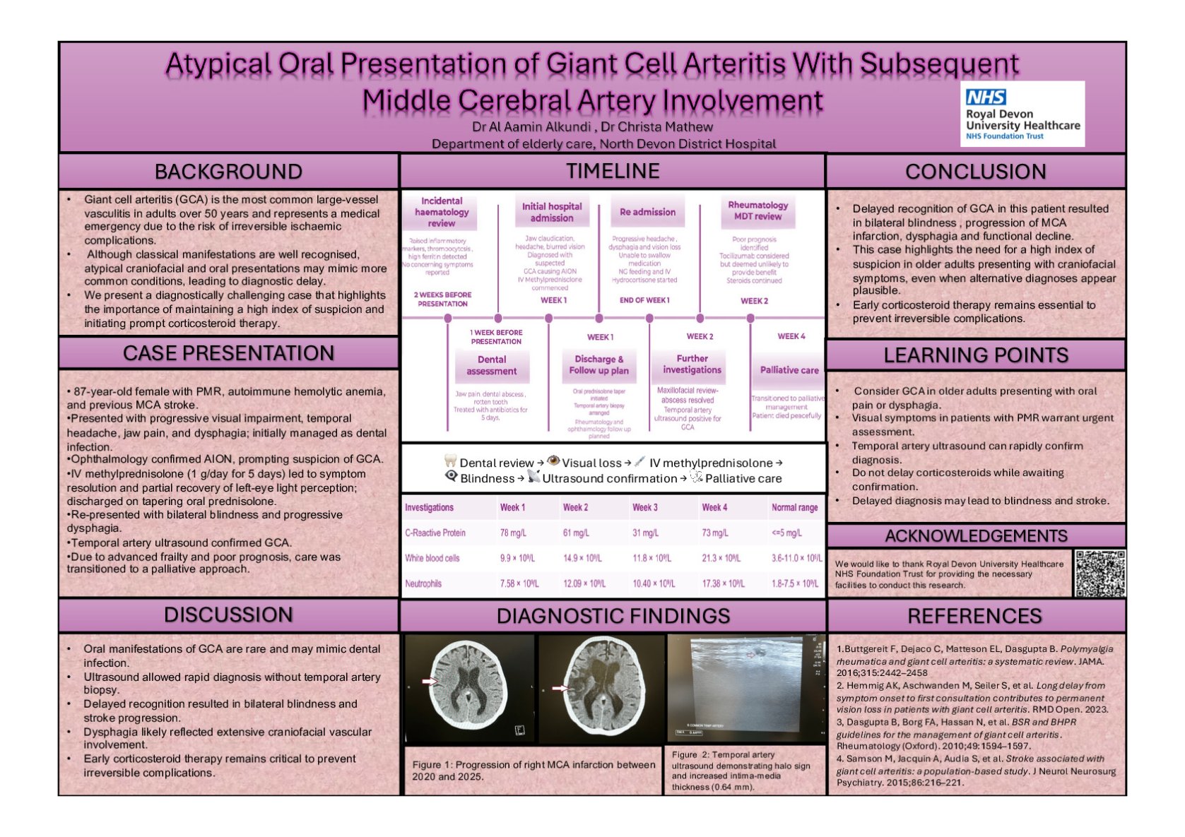 Atypical Oral Presentation of Giant Cell Arteritis With Subsequent Middle Cerebral Artery Involvement poster preview image