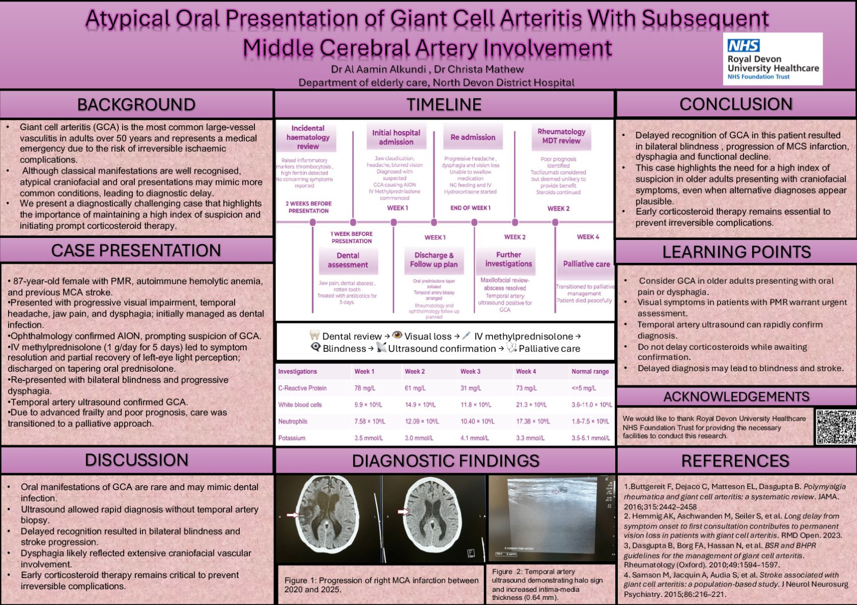 Atypical Oral Presentation of Giant Cell Arteritis With Subsequent Middle Cerebral Artery Involvement poster preview image
