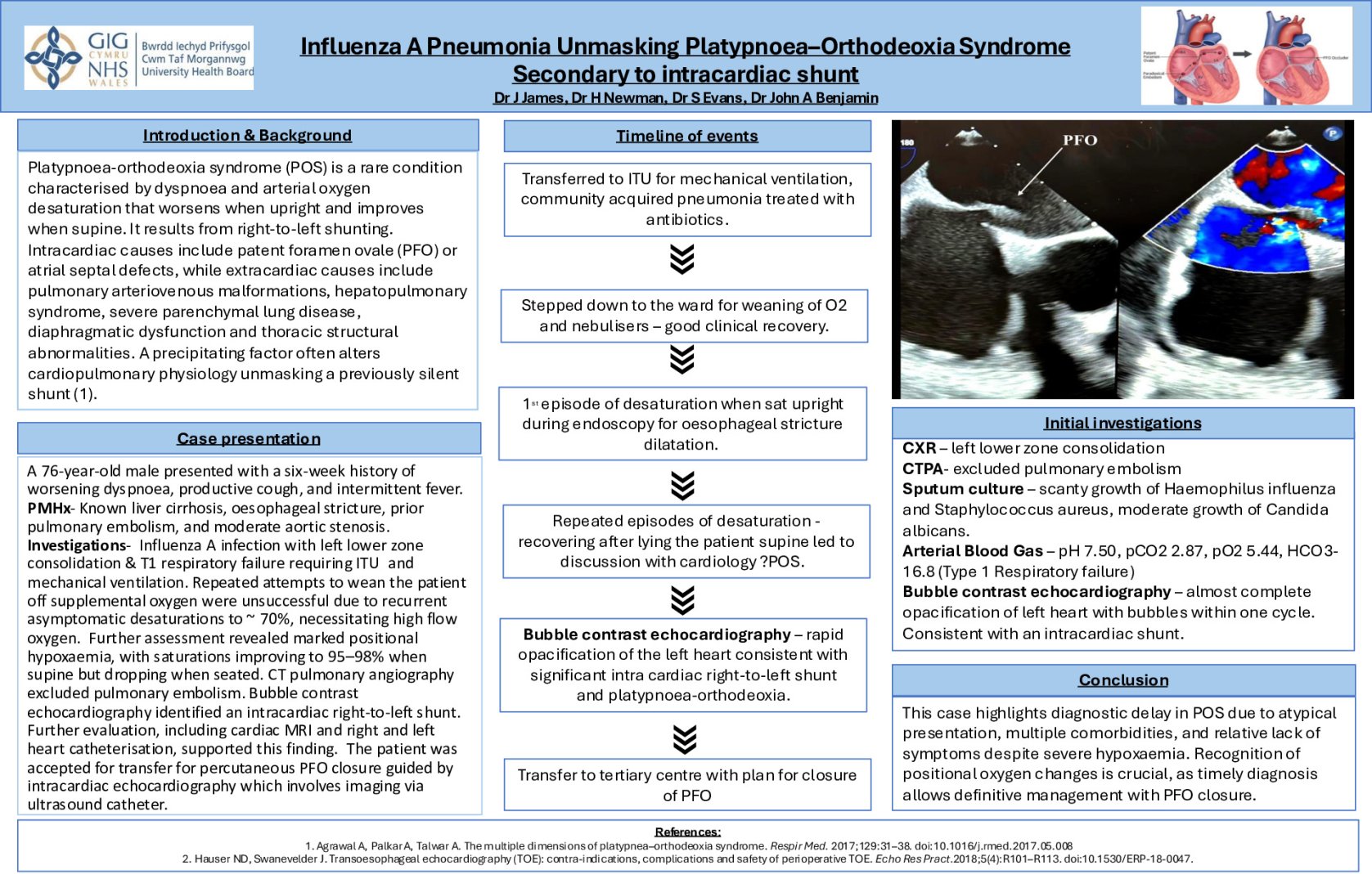 Influenza A Pneumonia Unmasking Platypnoea–Orthodeoxia Syndrome​ Secondary to Patent Foramen Ovale poster preview image