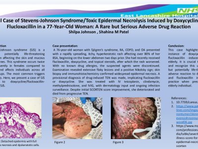 Fatal Case of Stevens-Johnson Syndrome/Toxic Epidermal Necrolysis Induced by Doxycycline or Flucloxacillin in Elderly poster preview image