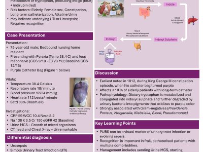 Purple Urine Bag Syndrome (PUBS) in a Bedbound Nursing Home Resident: A Rare Presentation of Urosepsis in an Elderly Patient poster preview image