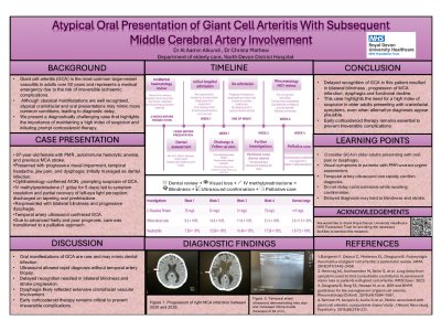 Atypical Oral Presentation of Giant Cell Arteritis With Subsequent Middle Cerebral Artery Involvement poster preview image