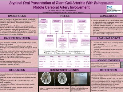 Atypical Oral Presentation of Giant Cell Arteritis With Subsequent Middle Cerebral Artery Involvement poster preview image
