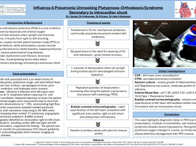 Influenza A Pneumonia Unmasking Platypnoea–Orthodeoxia Syndrome​ Secondary to Patent Foramen Ovale poster preview image